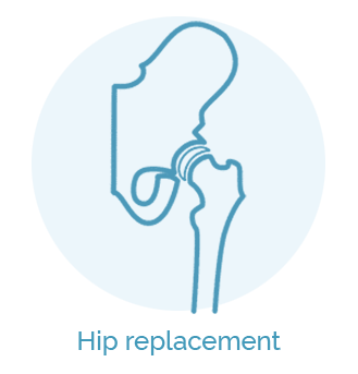 Hip-replacement_su uzrasais 1