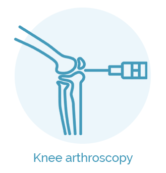Knee arthroscopy_su uzrasais 1
