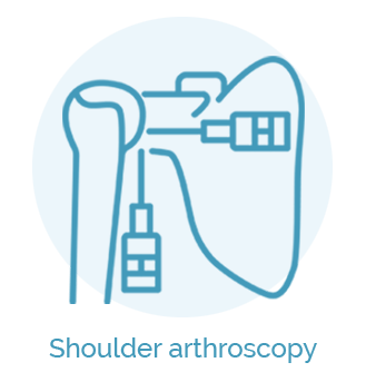Shoulder arthroscopy_su uzrasais 1