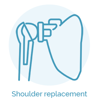 Shoulder replacement_su uzrasu 1