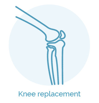 knee-replacement+su uzrasais 1
